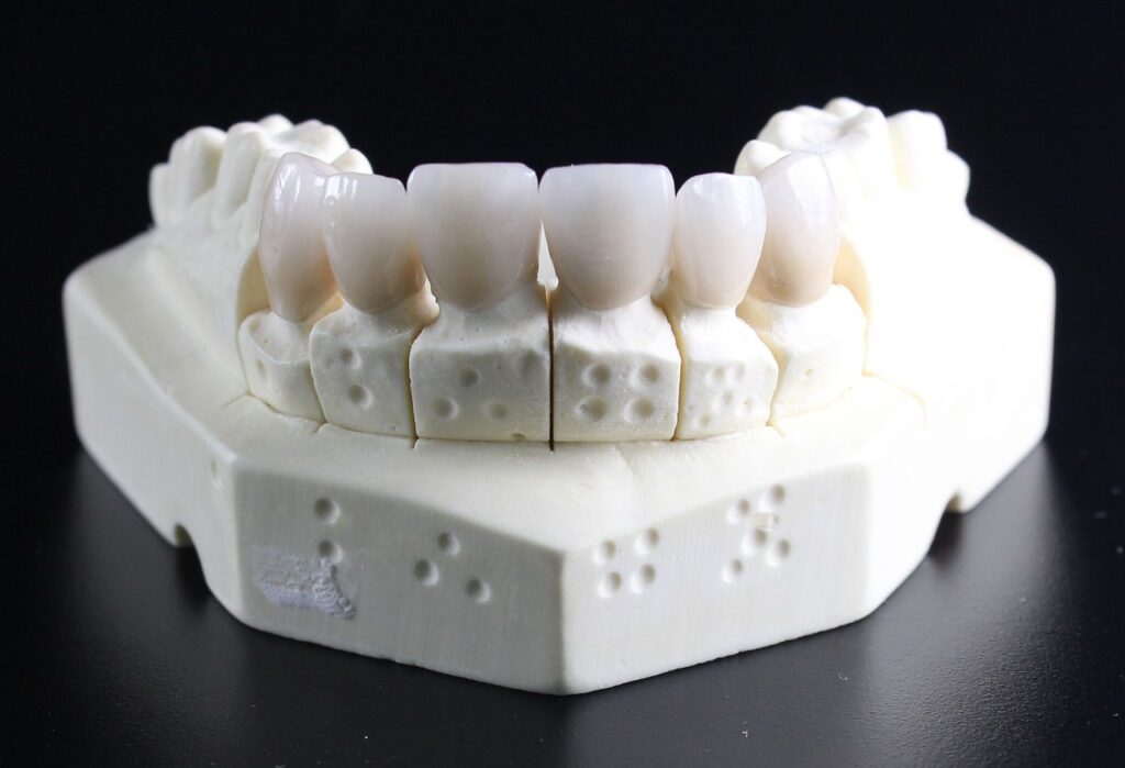 white denture